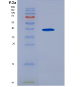 人巨噬细胞炎性蛋白1α(MIP1a)重组蛋白