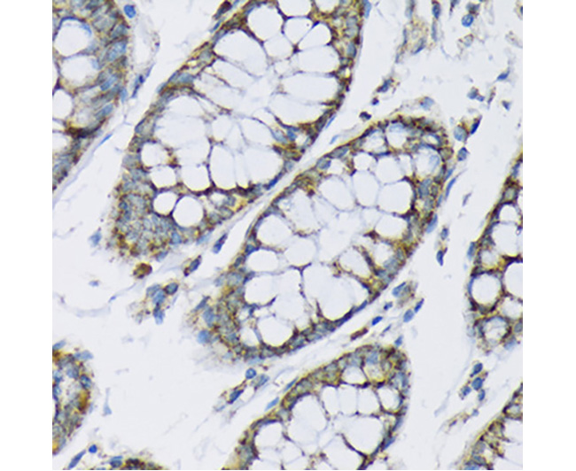 Hexokinase II Rabbit Polyclona