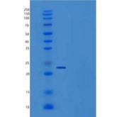 人生长激素1（GH1）重组蛋白His tag
