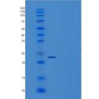 人生长激素1(GH1)重组蛋白His tag