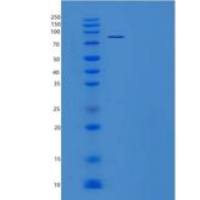 小鼠Smad同源物3(SMAD3)重组蛋白His & GST tag