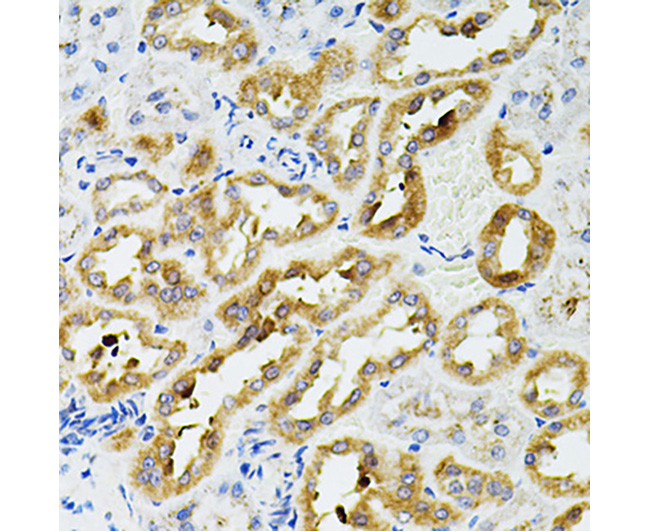 SIRT3 Rabbit Polyclonal Antibo