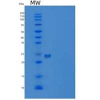 人神经钙蛋白δ(NCALd)重组蛋白N-6His