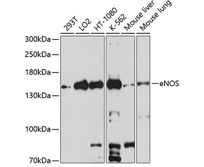 eNOS Rabbit Polyclonal Antibod