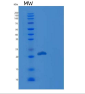 人生长激素1（GH1 ）重组蛋白