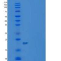 小鼠C-X-C基序趋化因子15/cxcl 15/肺因子重组蛋白C-6His