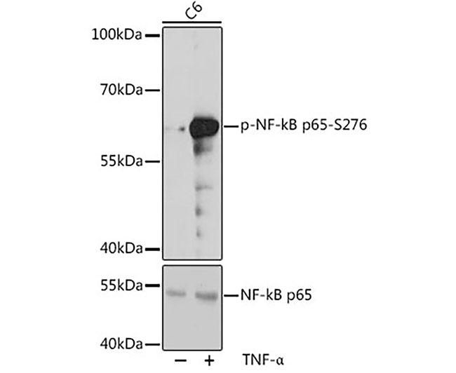 Phospho-NF-κB p65 (Ser276) Rab