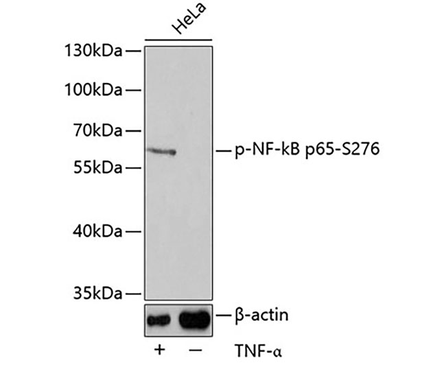 Phospho-NF-κB p65 (Ser276) Rab
