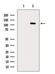 XRN2 antibody