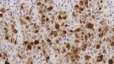 PLK1 antibody [MJS1]