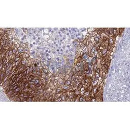 Claudin 4 antibody