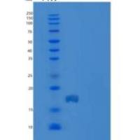 人CD7/白细胞介素-9重组蛋白C-6His