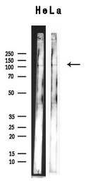 XRN2 antibody