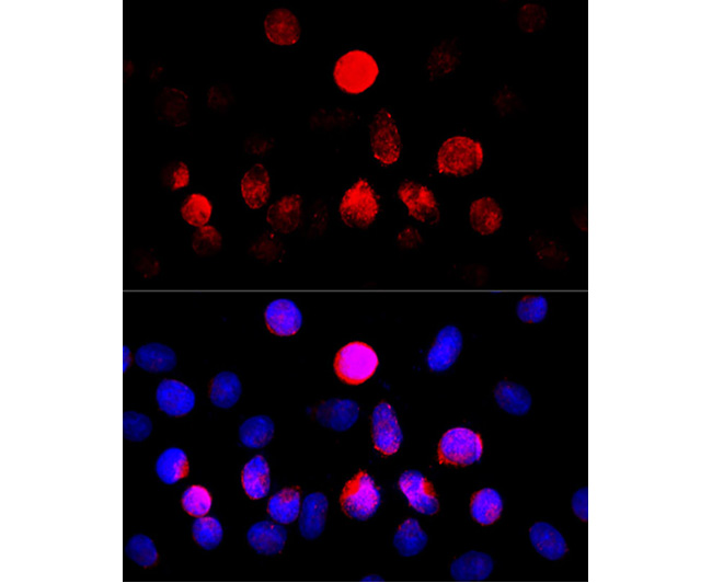 CYP11A1 Rabbit Polyclonal Anti