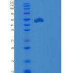 人PD-L1 / B7-H1 / CD274重组蛋白ECD, Fc Tag