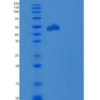 人PD-L1 / B7-H1 / CD274重组蛋白ECD, Fc Tag