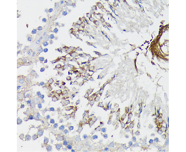 TNFR1 Rabbit Polyclonal Antibo