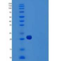 人肿瘤坏死因子样1(TNF-like 1)重组蛋白