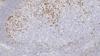 IRF4 / MUM1 antibody [EAU32]