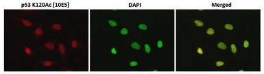 p53 (Acetyl Lys120) antibody [