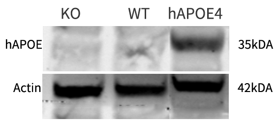 Apoe4-4.png Apoe4-4.png