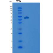 人CDKN2D / p19ink4d重组蛋白GST tag