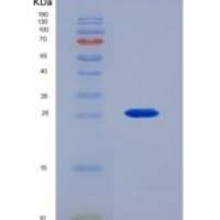 人成纤维细胞生长因子9(FGF9)重组蛋白