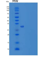 人磺基转移酶4A1/SULT4A1重组蛋白
