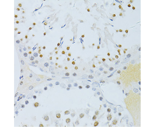 Phospho-NF-κB p65 (Ser276) Rab