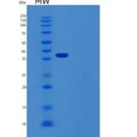 人n-酰基-芳香-L-氨基酸酰胺水解酶/ACY3重组蛋白N-6His