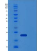 人IL-1RA / IL1RN重组蛋白