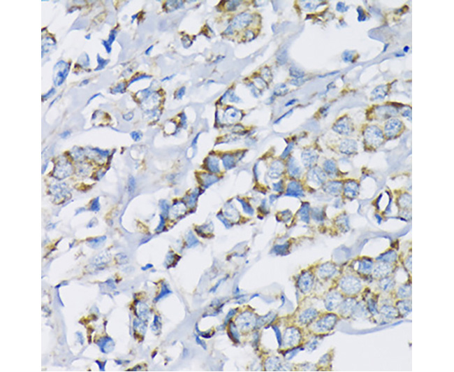 Hexokinase II Rabbit Polyclona