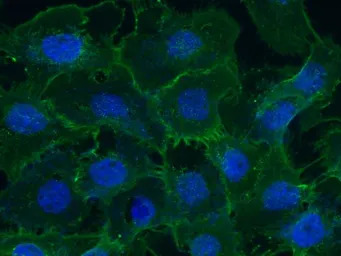 Coagulation factor III/Tissue 