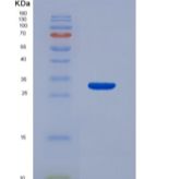 人白介素22受体α2(IL22Ra2)重组蛋白
