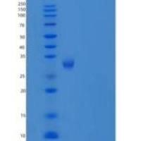 人神经递质/NTRI重组蛋白C-6His