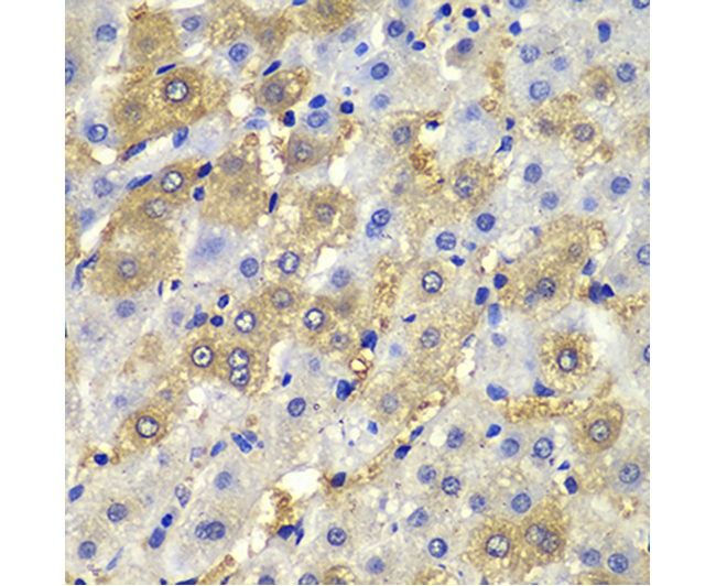 DSP Rabbit Polyclonal Antibody