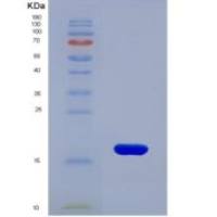 小鼠干扰素γ诱导单核因子(MIg)重组蛋白