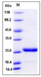 Mouse Prolactin protein, His t