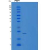 人泛素结合酶E2C结合蛋白E2D1(UBE2D1)重组蛋白His Tag
