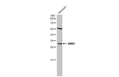 SMN1 antibody