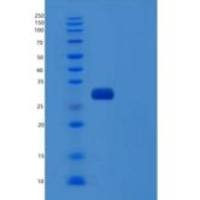 人泛素羧基端酯酶L3(UCHL3)重组蛋白C-6His