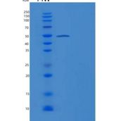 人14-3-3 sigma / Stratifin / YWHAS重组蛋白GST tag