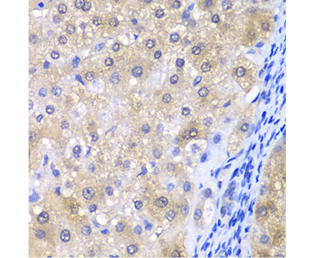 GPX4 Rabbit Polyclonal Antibod