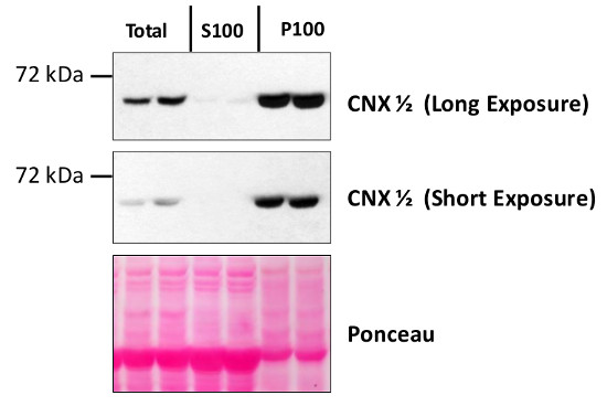 Anti-CNX1/2 | CALNEXIN HOMOLOG
