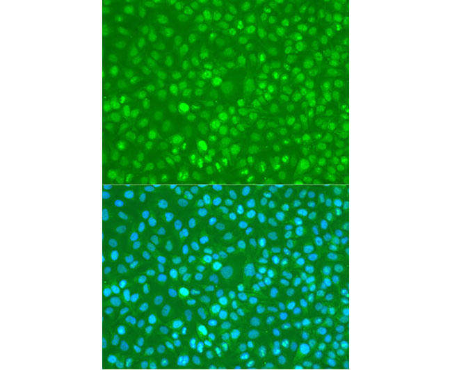 Phospho-NF-κB p65 (Ser276) Rab