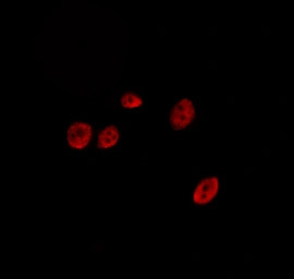 SENP2 antibody