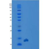 人TXNDC17 / TRP14 / TXNL5重组蛋白