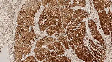 Dysferlin antibody [Ham1/7B6]