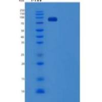 人USP5 / ISOT重组蛋白His tag