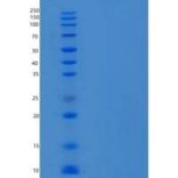 人C-C基序趋化因子5/CCL5/RANTES重组蛋白